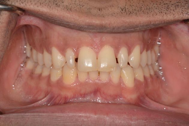 Cosmetic Dentistry: Case 1 - Before