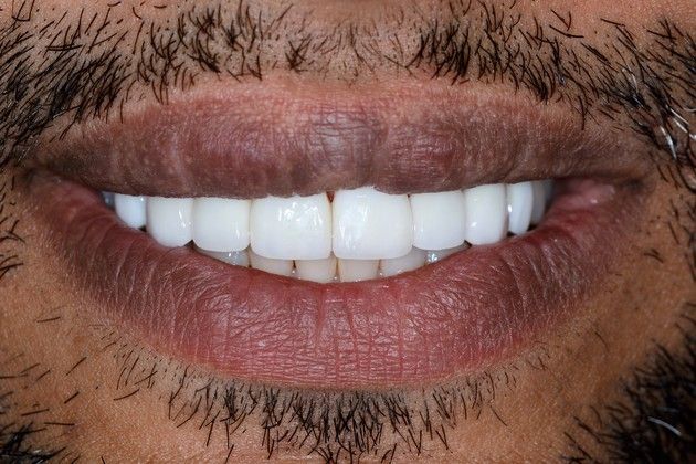 Cosmetic Dentistry Cases