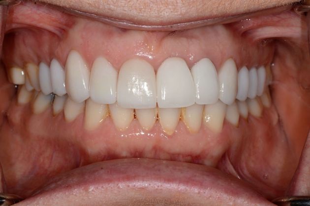 Cosmetic Dentistry: Case 2 - After