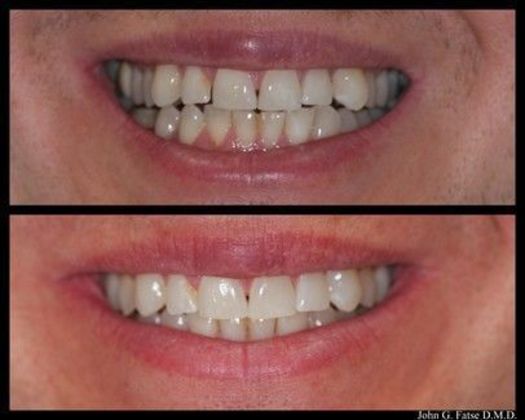 Dr. John Fatse: Case 1