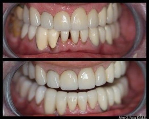 Dr. John Fatse: Case 2