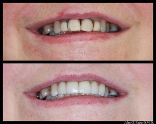 Dr. John Fatse: Case 3