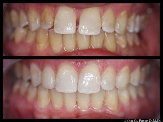 Dr. John Fatse: Case 4