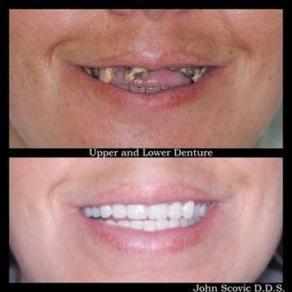 Dr. John Scovic Case 1