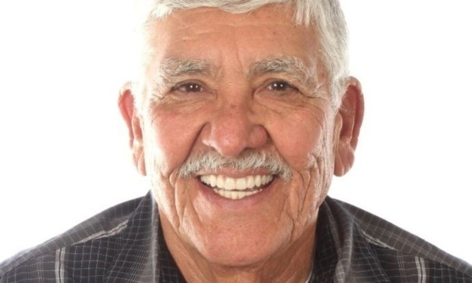 All on 4 Dental Implants Case 8 - After