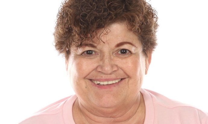 All on 4 Dental Implants Case 6  - Before