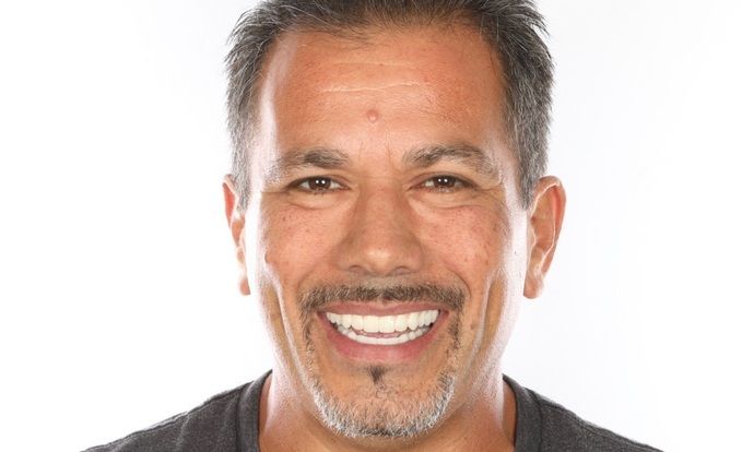 All on 4 Dental Implants Case 5  - After