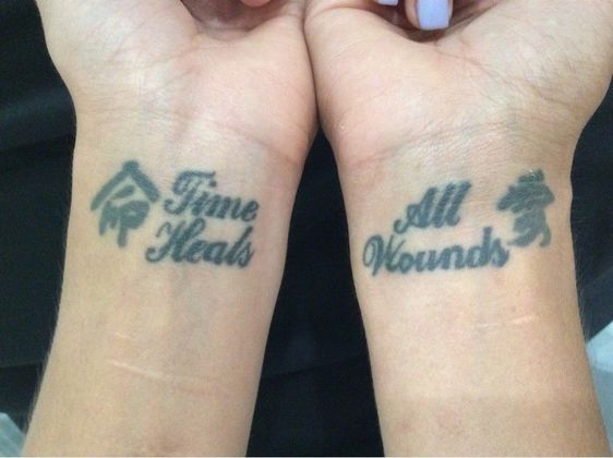 Laser Tattoo Removal Case 3 - Before