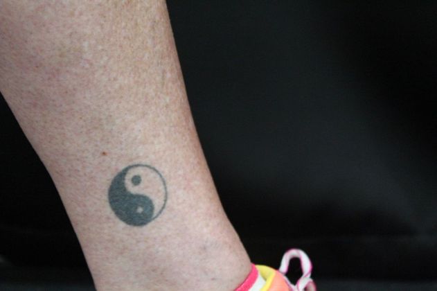 Laser Tattoo Removal Case 5 - Before