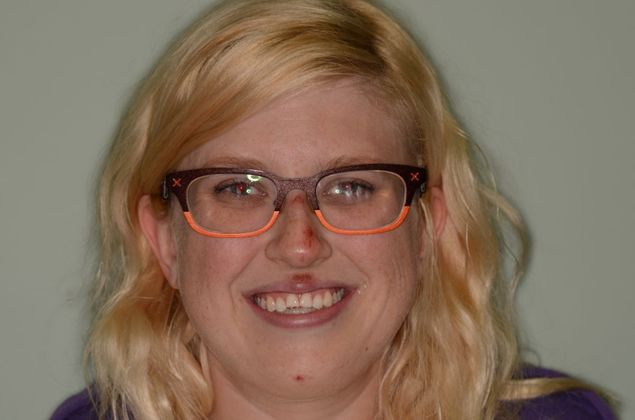 Porcelain Veneers: Case 3 - Before