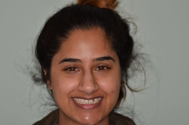 Dental Implants Case 22 - Before