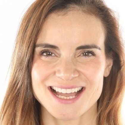 Porcelain Veneers Case 3 - After