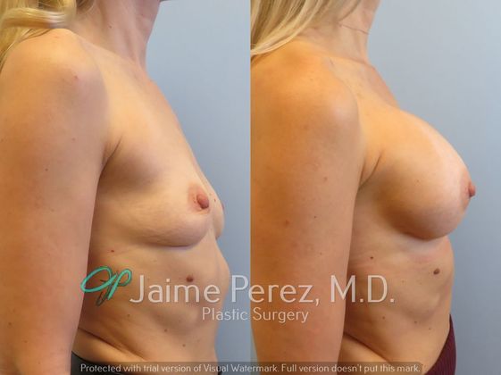 Before & After