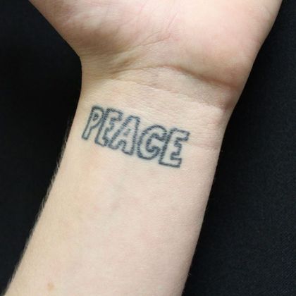 Laser Tattoo Removal Case 6 - Before