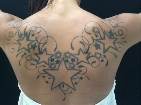 Case 9 Laser Tattoo Removal Before and After Gallery
