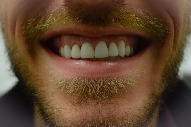 Same man with perfect smile