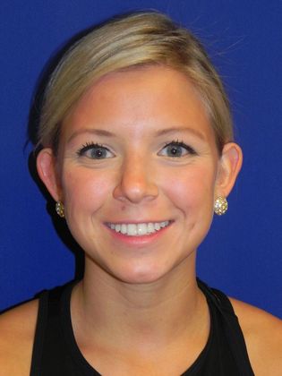 Ear Correction / Otoplasty: Case 2 (22395) - Before