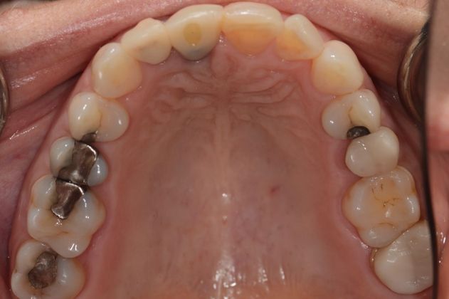 Cosmetic Dentistry: Case 2 - Before