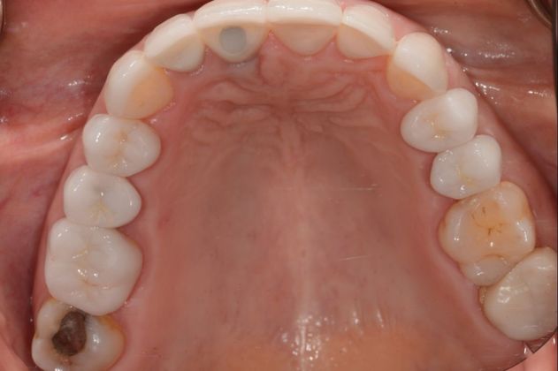 Cosmetic Dentistry: Case 2 - After