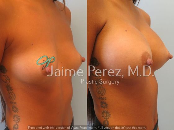 Before & After
