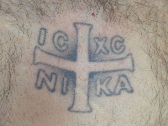 Tattoo Removal : Tattoo Removal 8 - Before