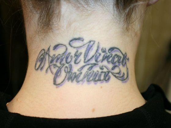 Tattoo Removal : Tattoo Removal 9 - Before