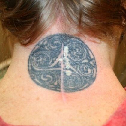 Tattoo Removal : Tattoo Removal 4 - Before