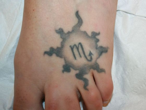 Tattoo Removal : Tattoo Removal 2 - Before