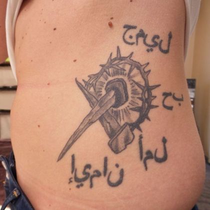 Tattoo Removal : Tattoo Removal 11 - Before