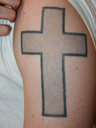 Tattoo Removal : Tattoo Removal 6 - Before