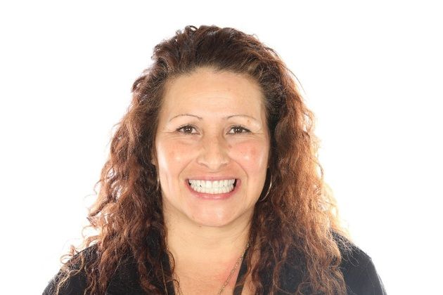 All on 4 Dental Implants Case 4  - After