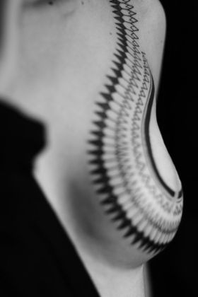 Breast Reconstruction - Implants: Case 2 - After Final Tattoo