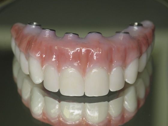 Teeth in a Day: Joseph - Top