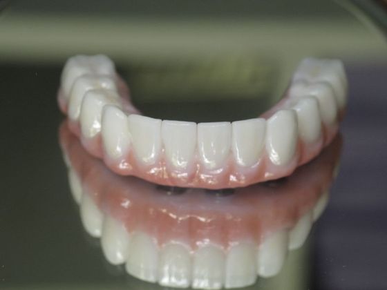 Teeth in a Day: Joseph - Bottom