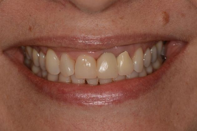 Cosmetic Dentistry Case 2 - Before