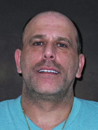 Prettau Zirconia Implant Bridge: Officer Chris - After