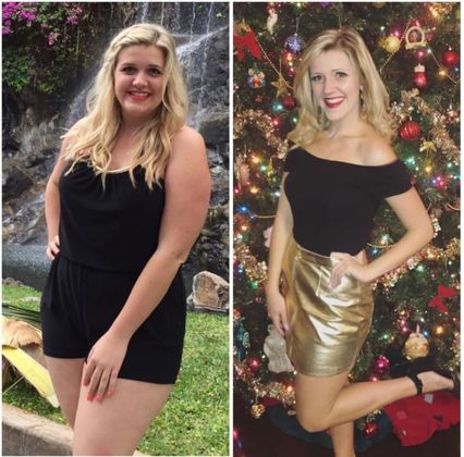 Gastric Sleeve - Click Here to See More! : Case 21 - Before & After