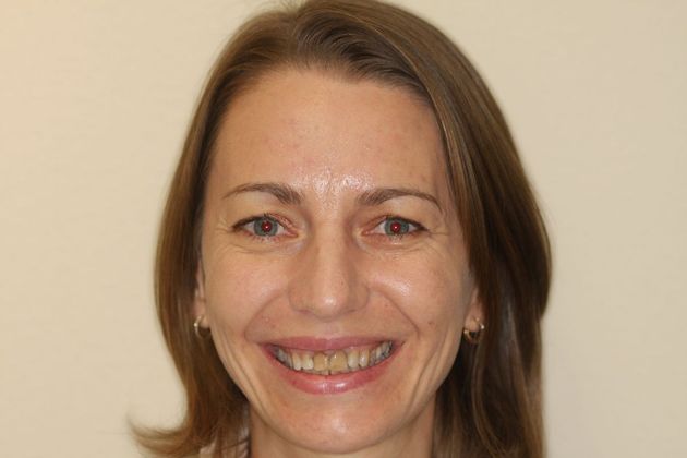 Porcelain Veneers: Case 18 - Before