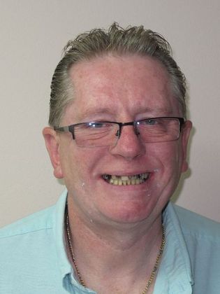 Teeth in a Day Officer Ronald - Before