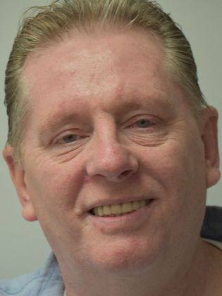 Teeth in a Day Officer Ronald - After