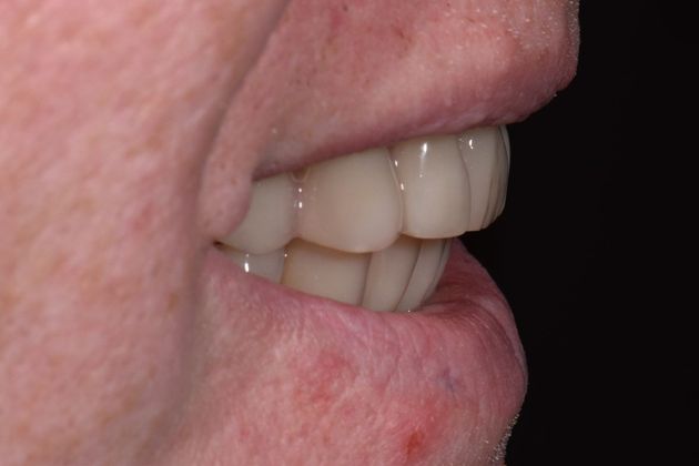 Teeth in a Day: Officer Ronald - Before