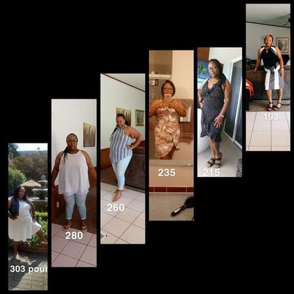 Gastric Sleeve - Click Here to See More! : Case 22 - Before & After