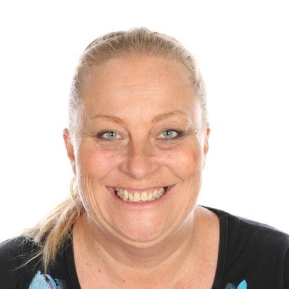 All on 4 Dental Implants Case 11 - Before