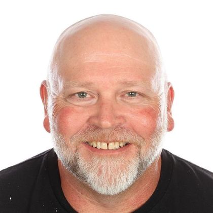 All on 4 Dental Implants Case 12 - Before