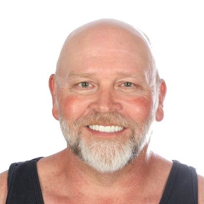 All on 4 Dental Implants Case 12 - After