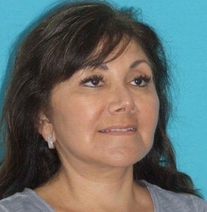 Mini Facelift: Case 14 - After