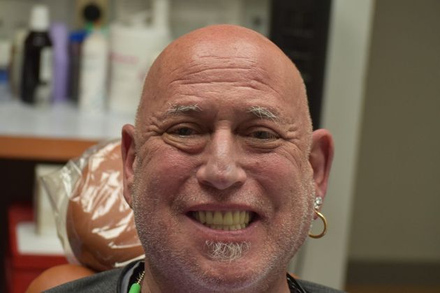 Teeth in a Day: Howard - After