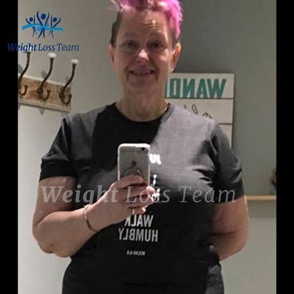 Gastric Bypass Case 3 - After