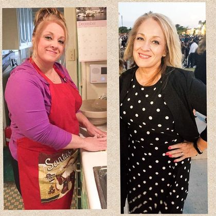 Gastric Sleeve - Click Here to See More! : Case 28 - Before & After