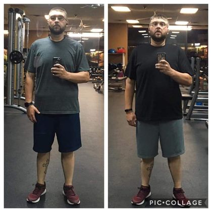 Gastric Sleeve - Click Here to See More! : Case 31 - Before & After